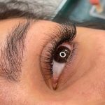 کاشت مژه هیدن